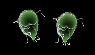 giardia_apert