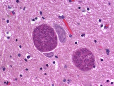neospora