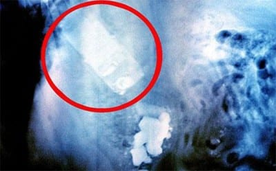 Un cellulare ingoiato dal cane. Estratto anche questo, il cane ora sta bene.